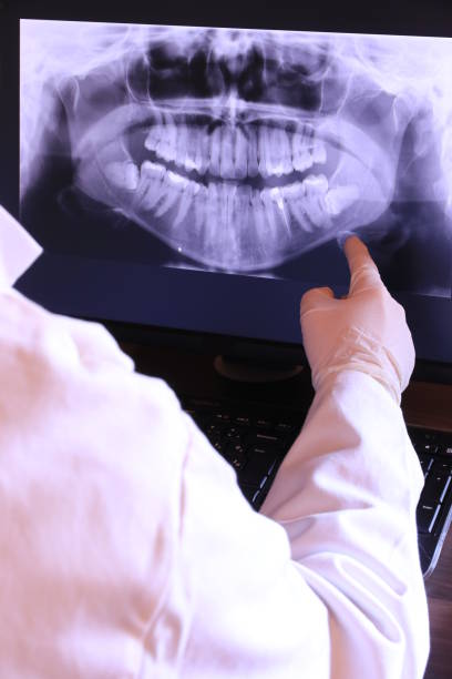 Best Emergency Wisdom Teeth Removal in Saluda, SC