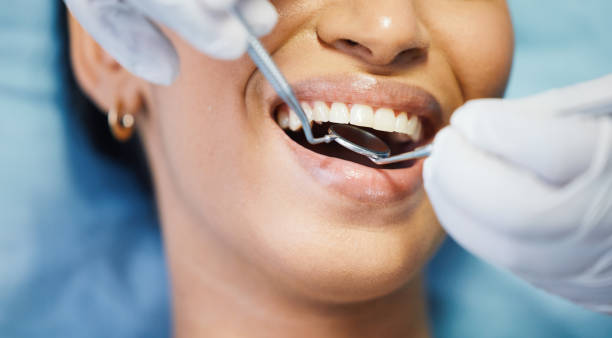 Best Emergency Tooth Extraction in Saluda, SC